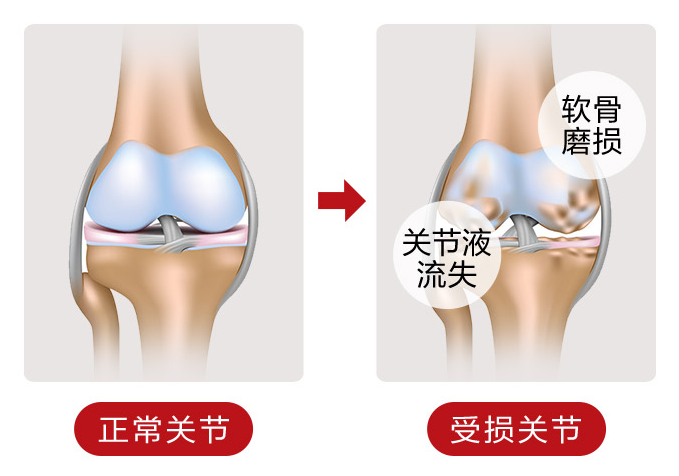 维力维氨糖软骨素饭前还是饭后吃好呢? 维力维氨糖软骨素饭前还是饭后吃好呢?