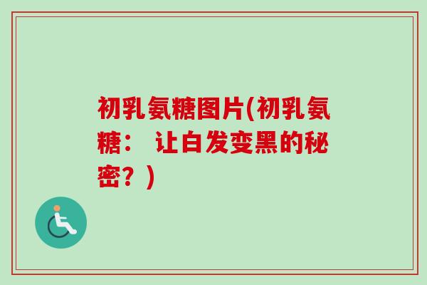 初乳氨糖图片(初乳氨糖: 让白发变黑的秘密?) 初乳氨糖图片(初乳氨糖: 让白发变黑的秘密?)