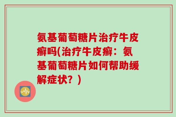 氨基葡萄糖片治疗牛皮癣吗(治疗牛皮癣：氨基葡萄糖片如何帮助缓解症状？)