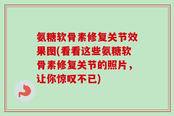 氨糖软骨素修复关节效果图(看看这些氨糖软骨素修复关节的照片，让你惊叹不已)