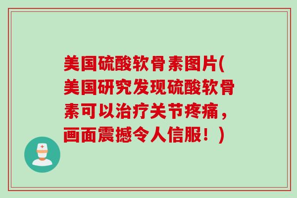 美国硫酸软骨素图片(美国研究发现硫酸软骨素可以治疗关节疼痛，画面震撼令人信服！)