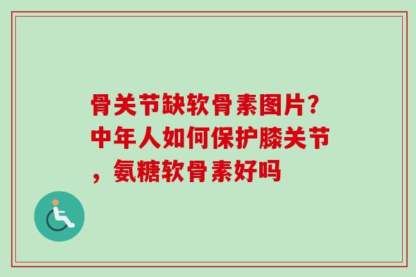 骨关节缺软骨素图片？中年人如何保护膝关节，氨糖软骨素好吗