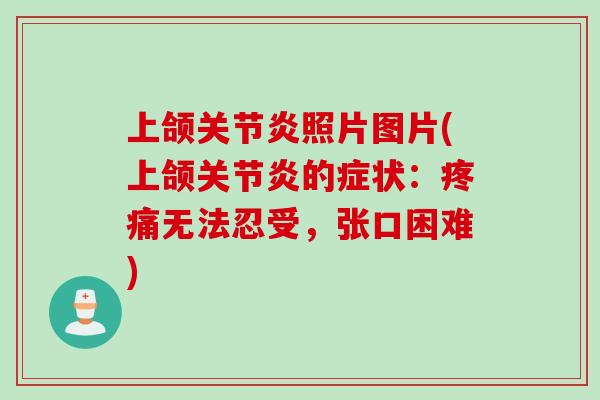 上颌关节炎照片图片(上颌关节炎的症状：疼痛无法忍受，张口困难)