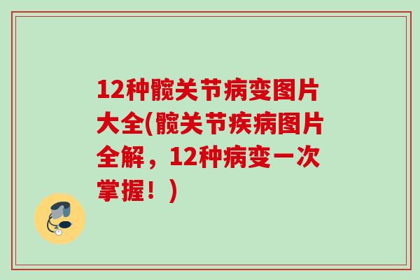 12种髋关节病变图片大全(髋关节疾病图片全解，12种病变一次掌握！)