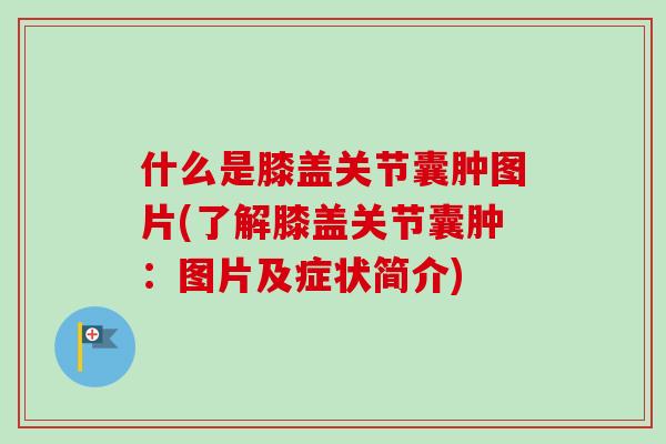 什么是膝盖关节囊肿图片(了解膝盖关节囊肿：图片及症状简介)