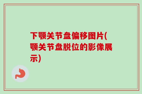下颚关节盘偏移图片(颚关节盘脱位的影像展示)