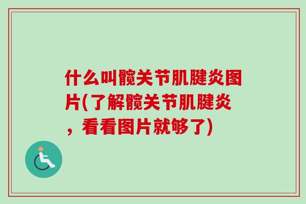 什么叫髋关节图片(了解髋关节,看看图片就够了) 什么叫髋关节图片(了解髋关节,看看图片就够了)