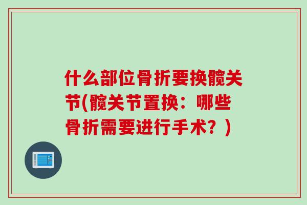 什么部位骨折要换髋关节(髋关节置换：哪些骨折需要进行手术？)