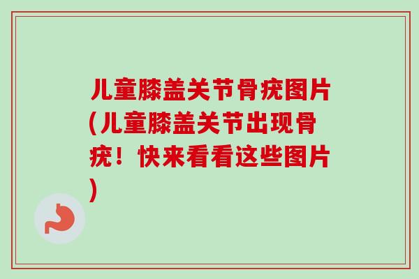 儿童膝盖关节骨疣图片(儿童膝盖关节出现骨疣！快来看看这些图片)