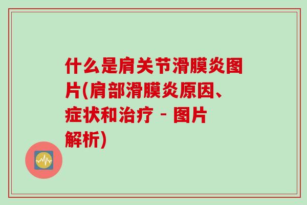 什么是肩关节滑膜炎图片(肩部滑膜炎原因、症状和治疗 - 图片解析)