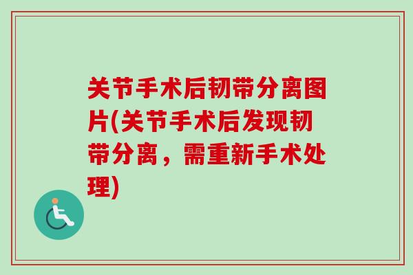 关节手术后韧带分离图片(关节手术后发现韧带分离，需重新手术处理)