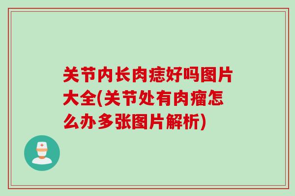 关节内长肉痣好吗图片大全(关节处有肉瘤怎么办多张图片解析)