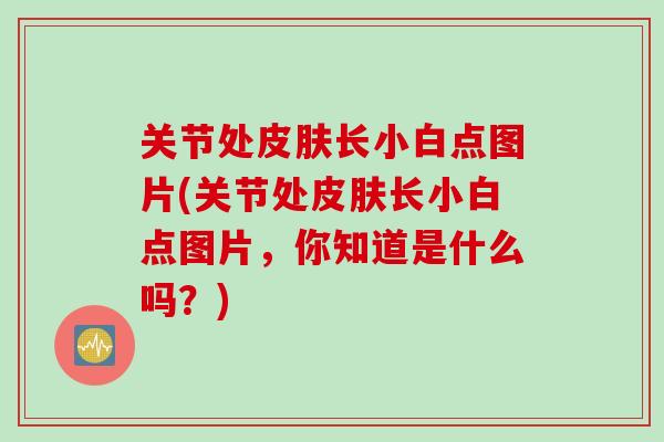 关节处皮肤长小白点图片(关节处皮肤长小白点图片，你知道是什么吗？)