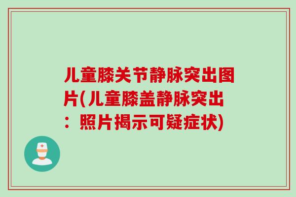 儿童膝关节静脉突出图片(儿童膝盖静脉突出：照片揭示可疑症状)