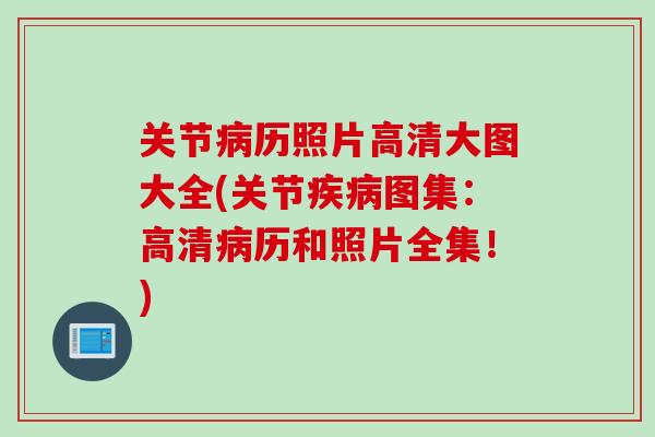 关节病历照片高清大图大全(关节疾病图集：高清病历和照片全集！)