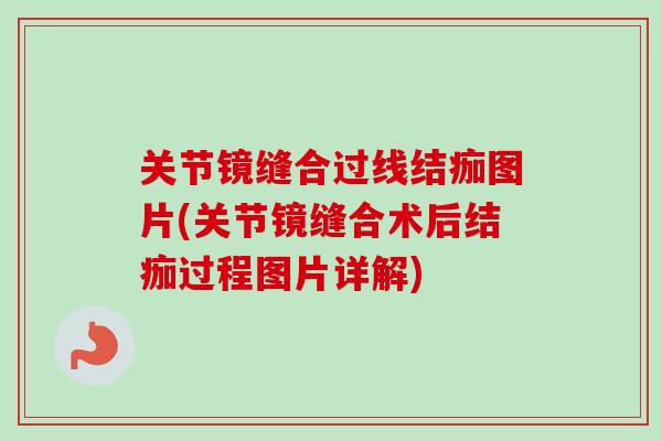 关节镜缝合过线结痂图片(关节镜缝合术后结痂过程图片详解)