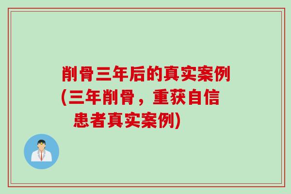 削骨三年后的真实案例(三年削骨，重获自信  患者真实案例)