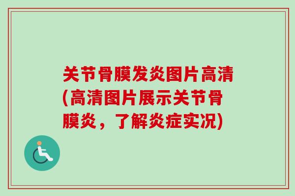 关节骨膜发炎图片高清(高清图片展示关节骨膜炎，了解炎症实况)