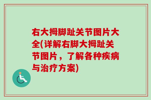 右大拇脚趾关节图片大全(详解右脚大拇趾关节图片，了解各种疾病与治疗方案)