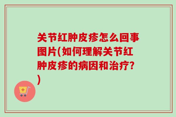 关节红肿皮疹怎么回事图片(如何理解关节红肿皮疹的病因和治疗？)