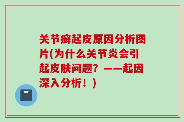 关节癣起皮原因分析图片(为什么会引起问题?——起因深入分析!) 关节癣起皮原因分析图片(为什么会引起问题?——起因深入分析!)