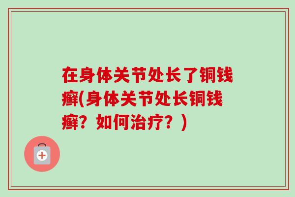 在身体关节处长了铜钱癣(身体关节处长铜钱癣？如何治疗？)