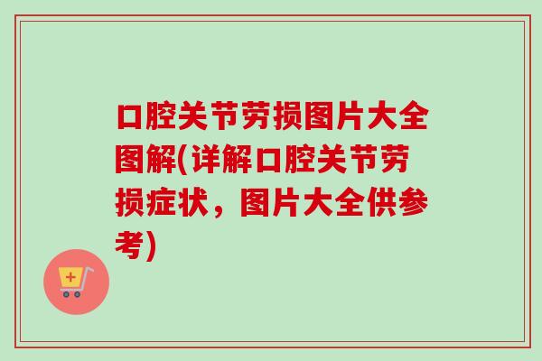 口腔关节劳损图片大全图解(详解口腔关节劳损症状，图片大全供参考)