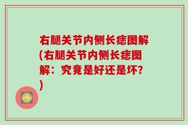 右腿关节内侧长痣图解(右腿关节内侧长痣图解：究竟是好还是坏？)