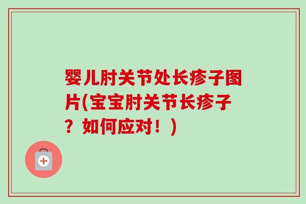 婴儿肘关节处长疹子图片(宝宝肘关节长疹子？如何应对！)