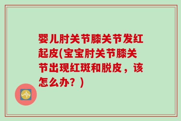 婴儿肘关节膝关节发红起皮(宝宝肘关节膝关节出现红斑和脱皮，该怎么办？)