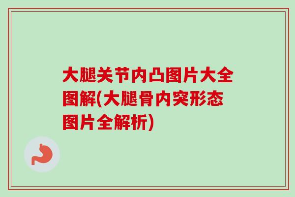 大腿关节内凸图片大全图解(大腿骨内突形态图片全解析)