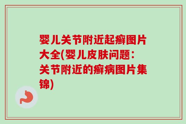 婴儿关节附近起癣图片大全(婴儿皮肤问题：关节附近的癣病图片集锦)