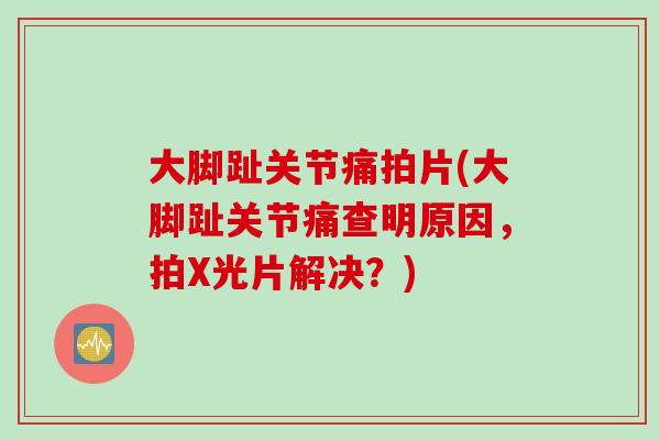 大脚趾关节痛拍片(大脚趾关节痛查明原因，拍X光片解决？)