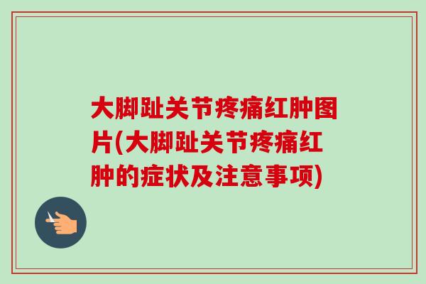 大脚趾关节疼痛红肿图片(大脚趾关节疼痛红肿的症状及注意事项)