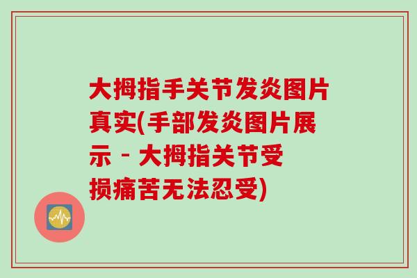大拇指手关节发炎图片真实(手部发炎图片展示 - 大拇指关节受损痛苦无法忍受)