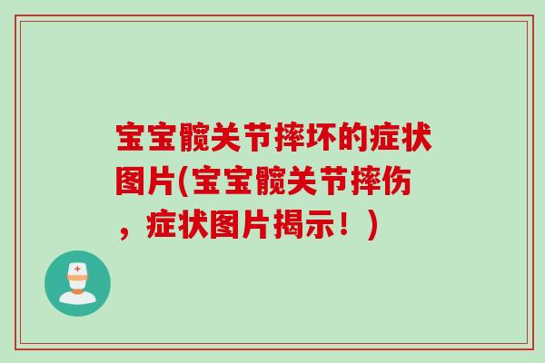 宝宝髋关节摔坏的症状图片(宝宝髋关节摔伤，症状图片揭示！)
