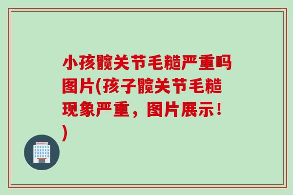 小孩髋关节毛糙严重吗图片(孩子髋关节毛糙现象严重，图片展示！)
