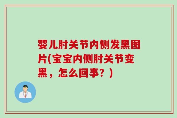 婴儿肘关节内侧发黑图片(宝宝内侧肘关节变黑,怎么回事?) 婴儿肘关节内侧发黑图片(宝宝内侧肘关节变黑,怎么回事?)