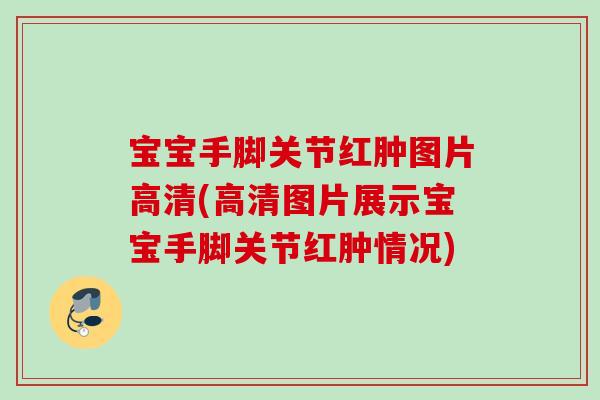 宝宝手脚关节红肿图片高清(高清图片展示宝宝手脚关节红肿情况)