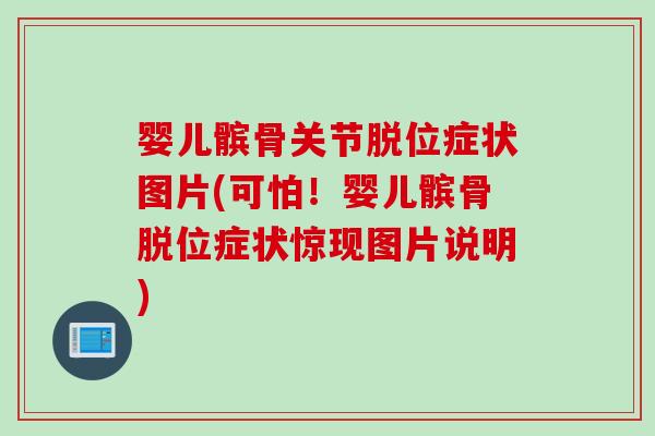 婴儿髌骨关节脱位症状图片(可怕！婴儿髌骨脱位症状惊现图片说明)