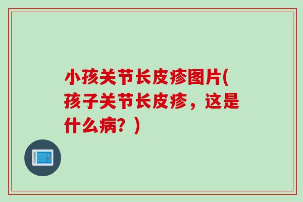 小孩关节长皮疹图片(孩子关节长皮疹，这是什么病？)