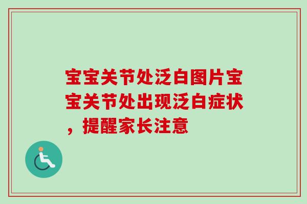 宝宝关节处泛白图片宝宝关节处出现泛白症状,提醒家长注意 宝宝关节处泛白图片宝宝关节处出现泛白症状,提醒家长注意