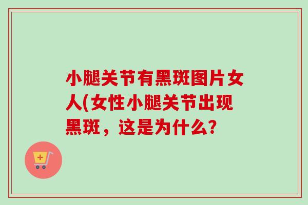 小腿关节有黑斑图片女人(女性小腿关节出现黑斑，这是为什么？