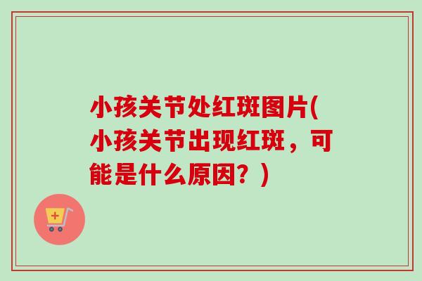 小孩关节处红斑图片(小孩关节出现红斑，可能是什么原因？)