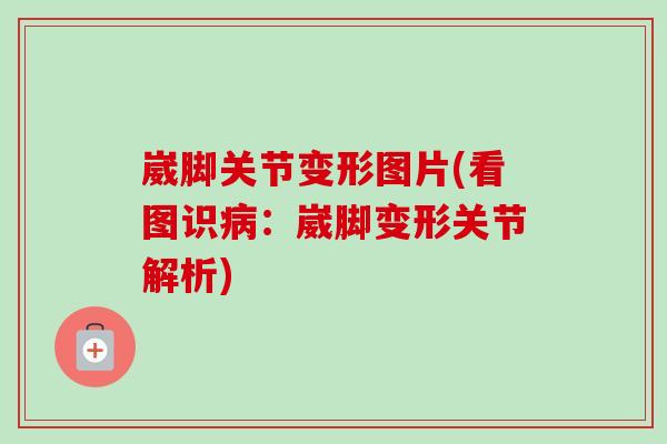 崴脚关节变形图片(看图识病：崴脚变形关节解析)