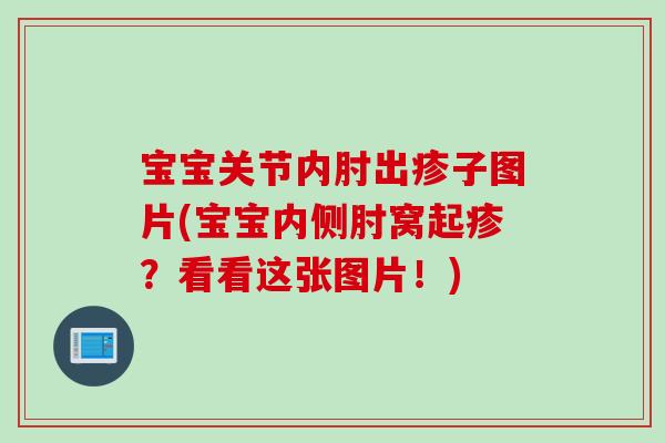宝宝关节内肘出疹子图片(宝宝内侧肘窝起疹？看看这张图片！)