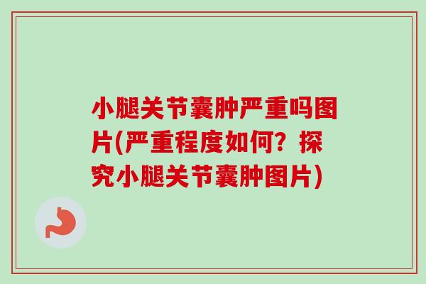 小腿关节囊肿严重吗图片(严重程度如何？探究小腿关节囊肿图片)