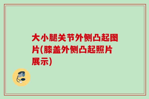 大小腿关节外侧凸起图片(膝盖外侧凸起照片展示)