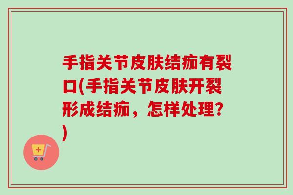 手指关节皮肤结痂有裂口(手指关节皮肤开裂形成结痂，怎样处理？)
