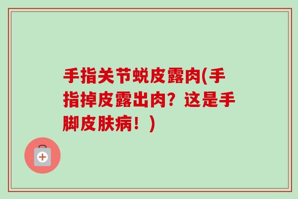 手指关节蜕皮露肉(手指掉皮露出肉？这是手脚皮肤病！)